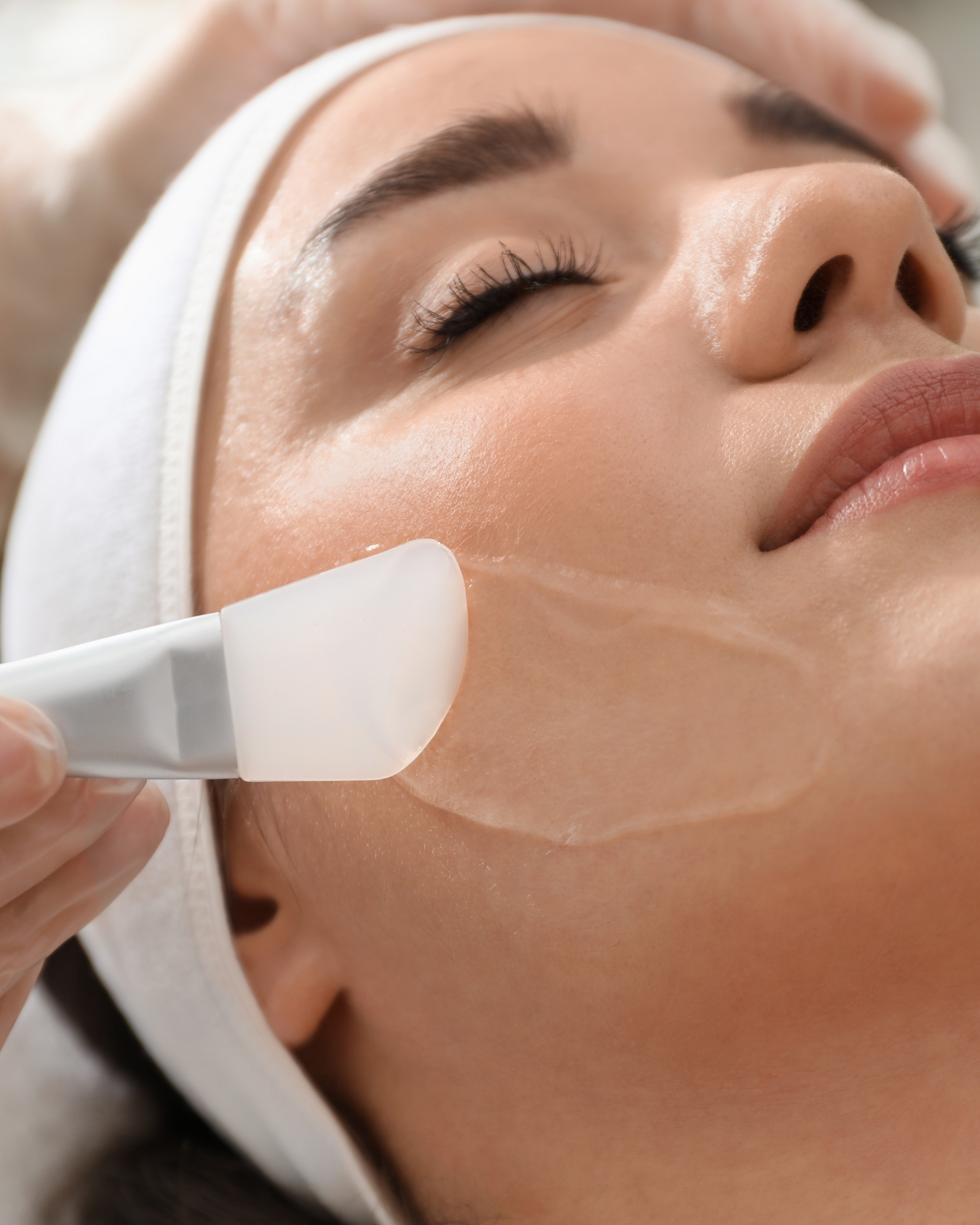 Chemical Peels