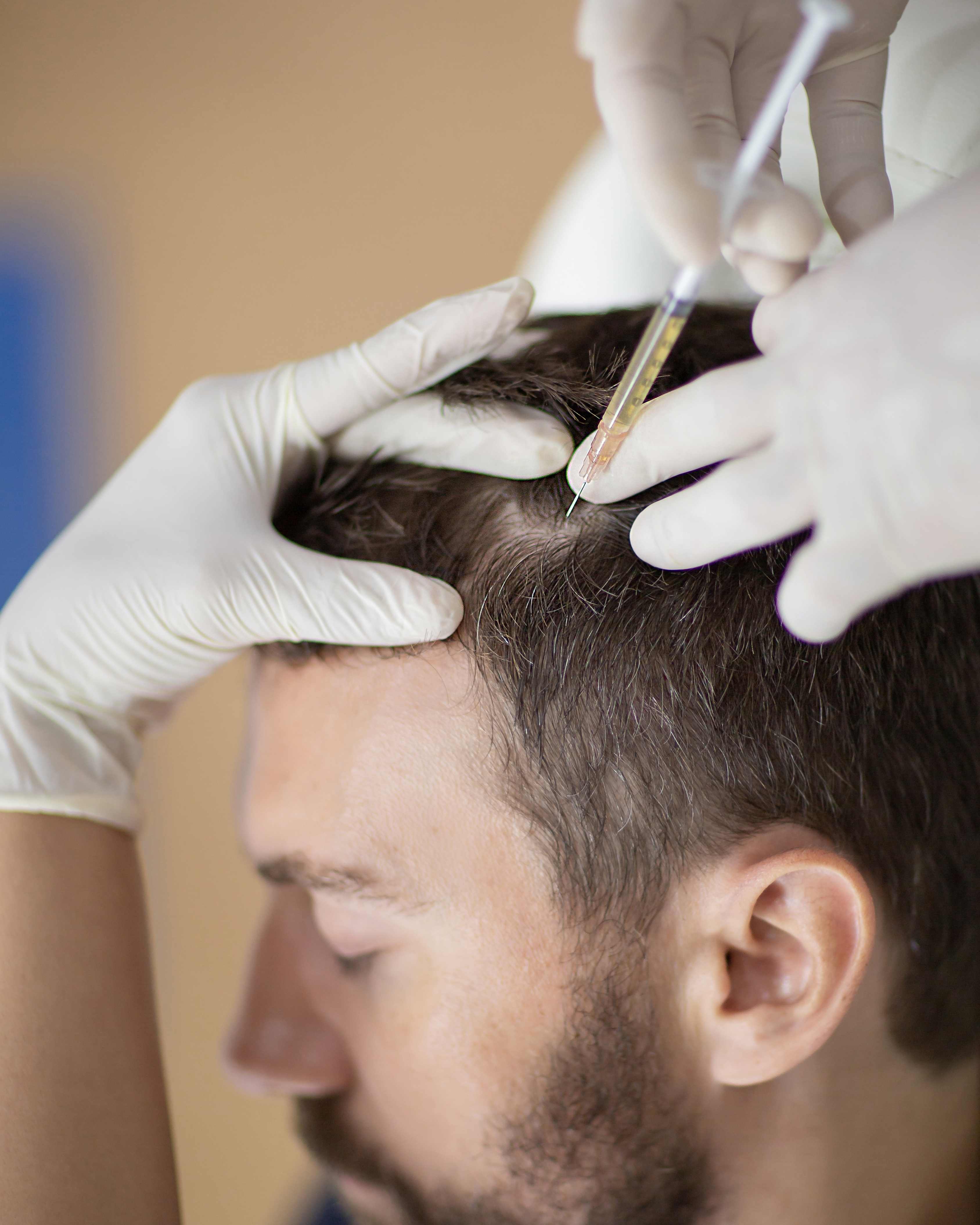 Hair GFC Therapy
