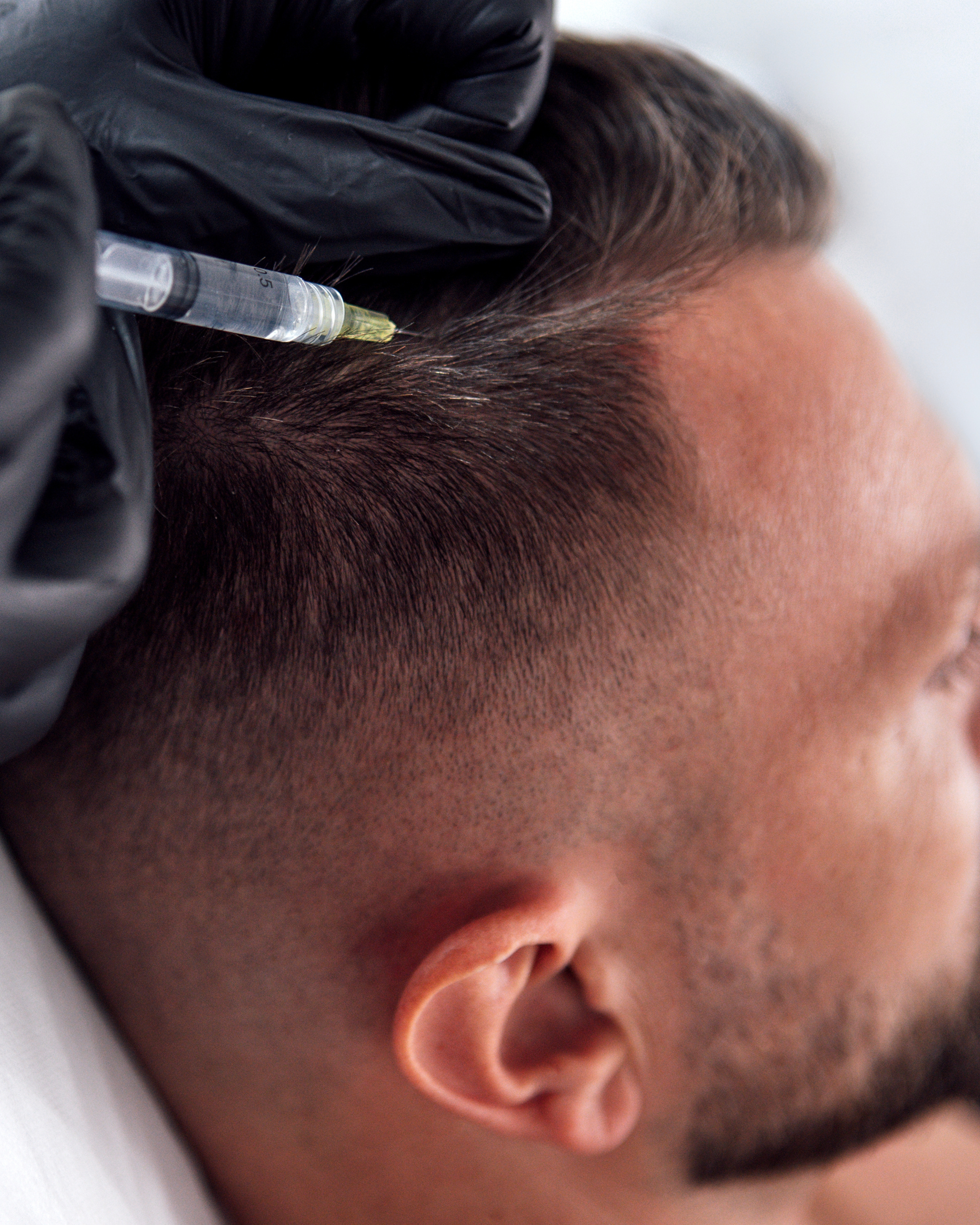Hair Restoration Therapy